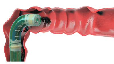 InchIGRAB: An Inchworm-Inspired Guided Retraction and Bending Device for Vine Robots During Colonoscopy featured image